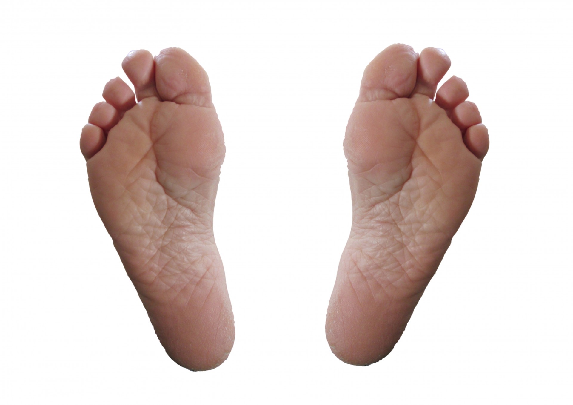 Why pimple bottom foot sole