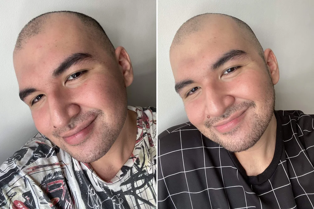 Before and after seven days of Estée Lauder ANR