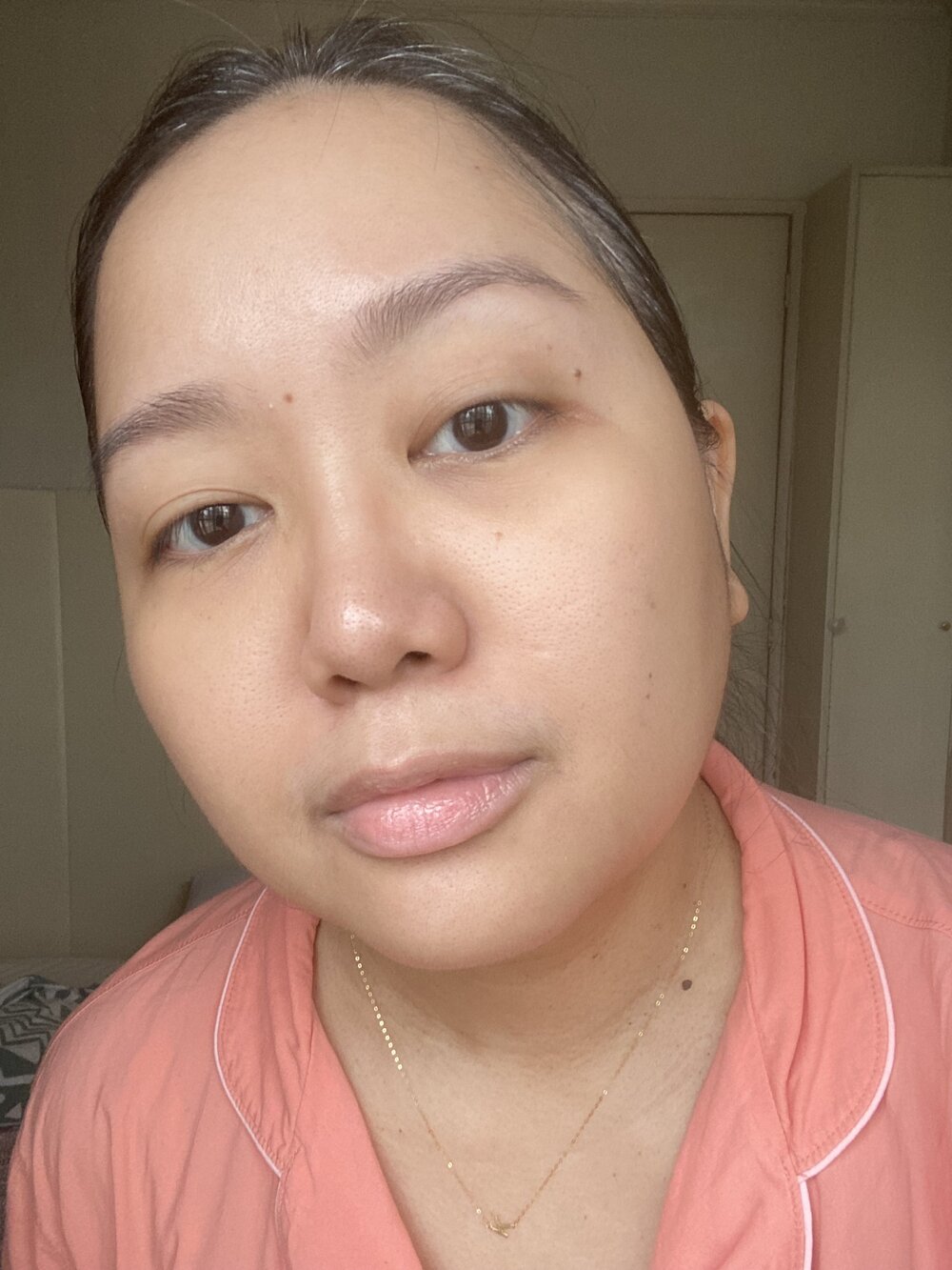 L: Before using the NEW Shiseido Ultimune with ImuGenerationRED Technology