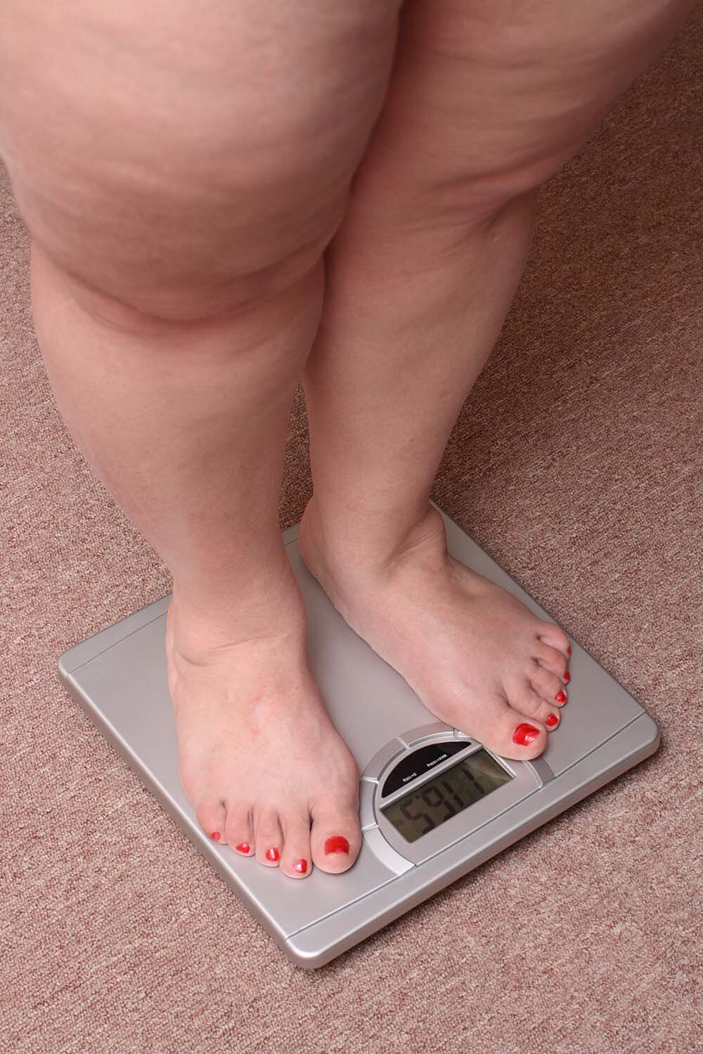 Лишний Вес На Ногах Как Избавиться