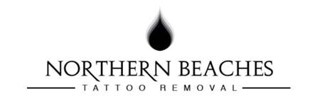Northern Beaches Tattoo Removal