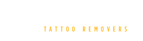 Invisible Ink Tattoo Removers in Pittsburgh, Minneapolis and Richmond. New Picosure Laser tattoo removal.