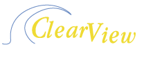 Mosquiteros Enrollables / ClearView Screens / mosquiteros enrollables motorizados Cancun / Playa del Carmen/ Mexico D.F.