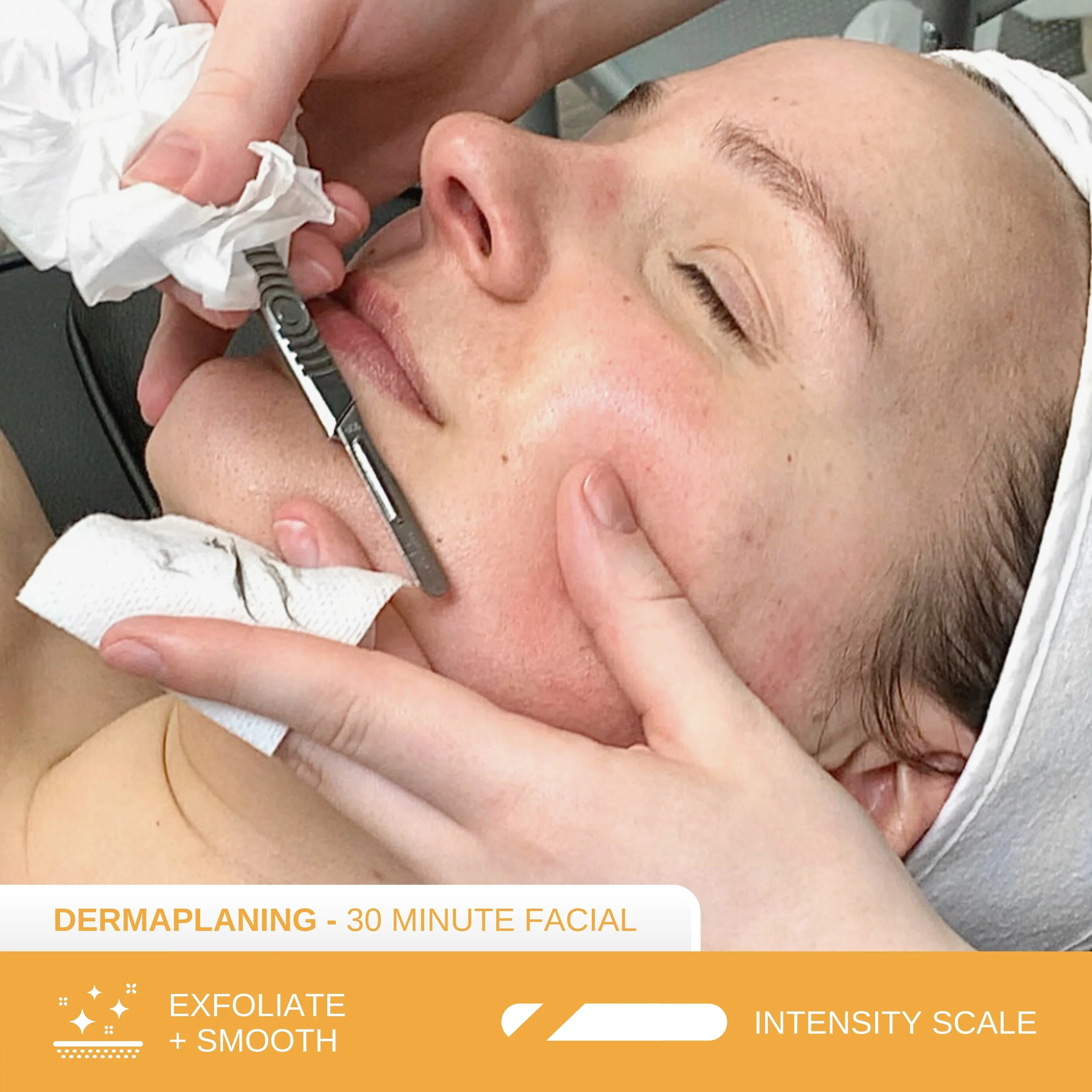 dermaplane facial
