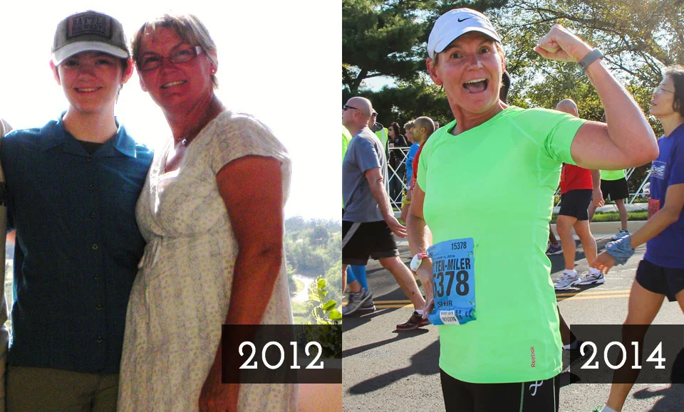 why sharon before after
