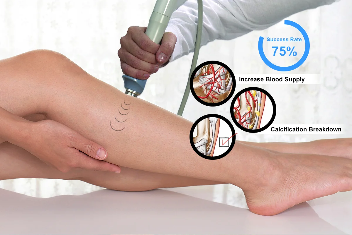 Вибратор Ударно Волновой