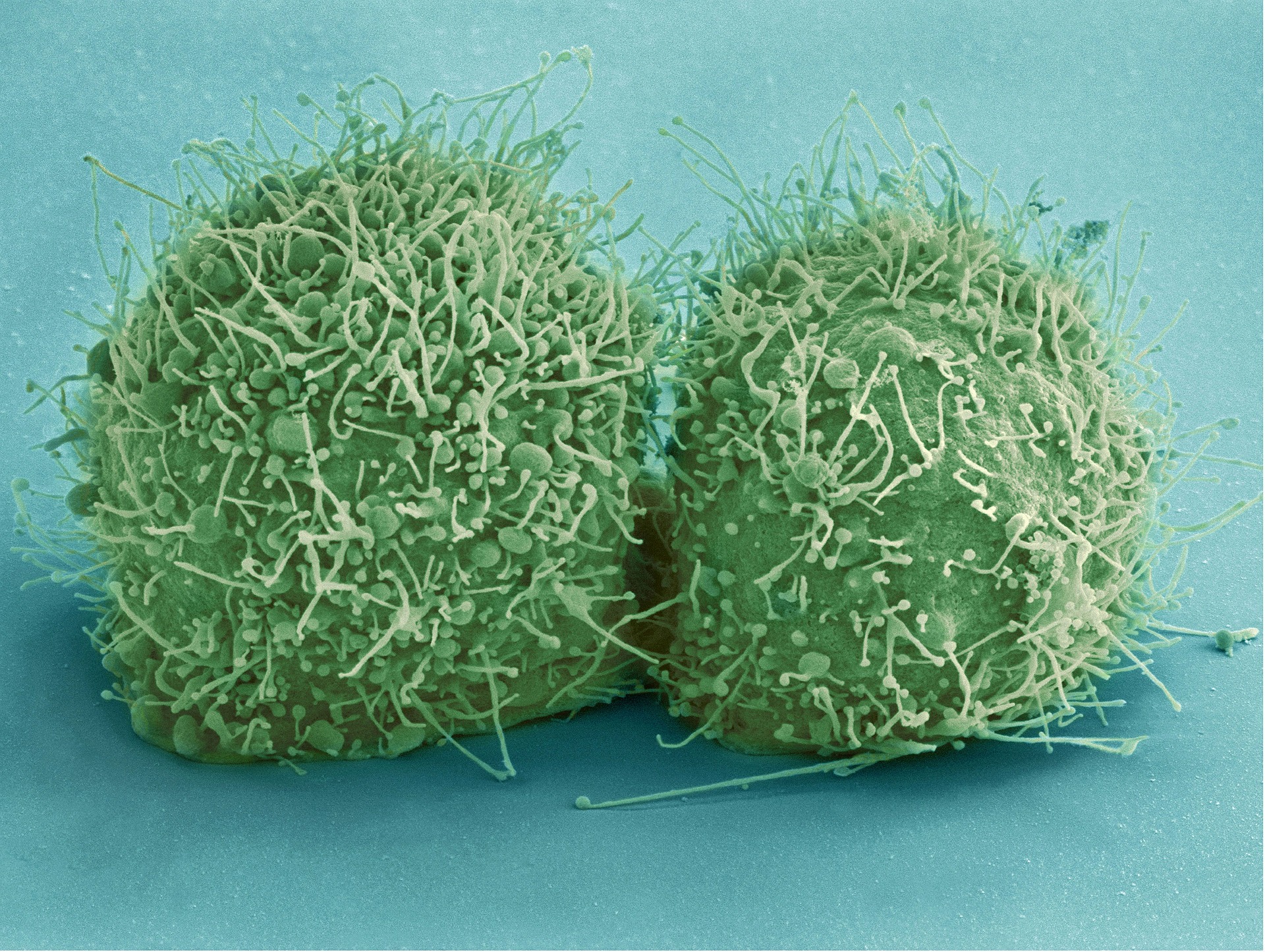 hela-cells-544318_1920.jpg