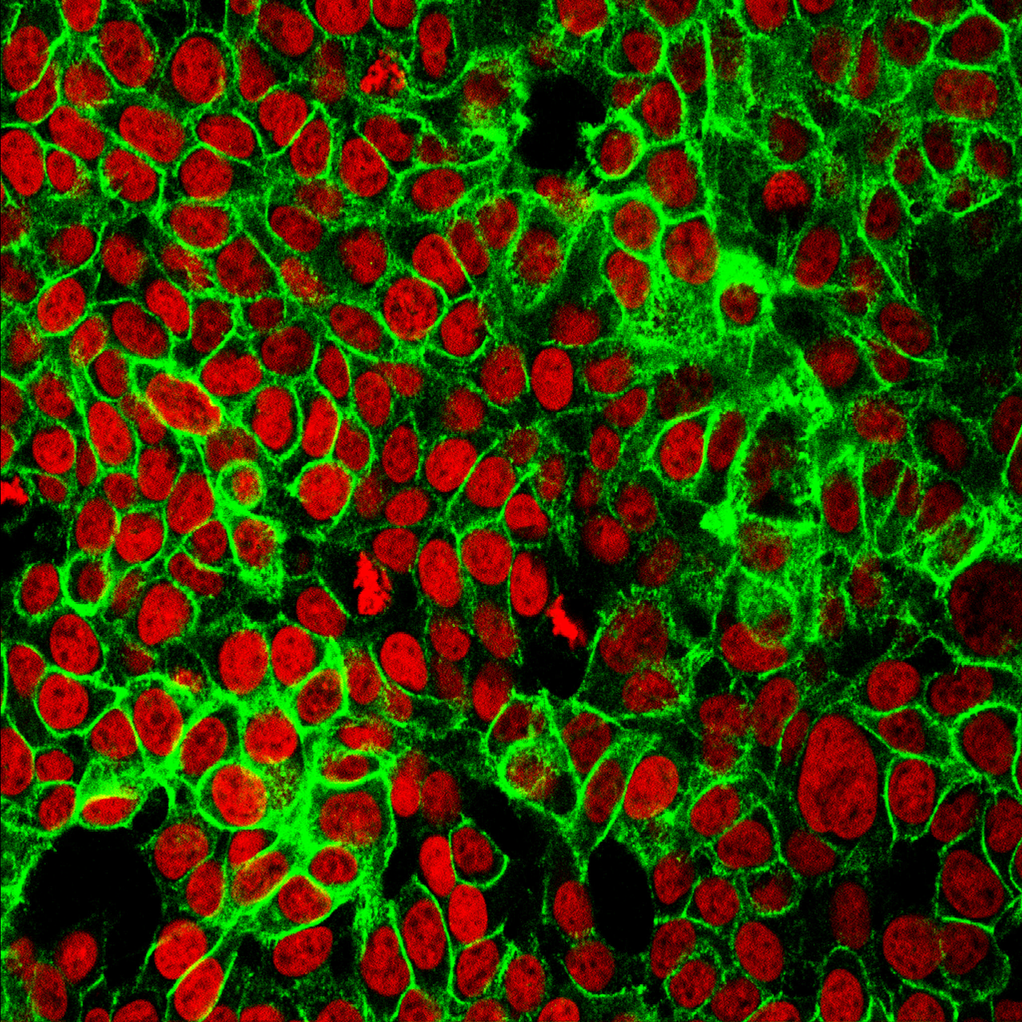 Cancer_cells.jpg