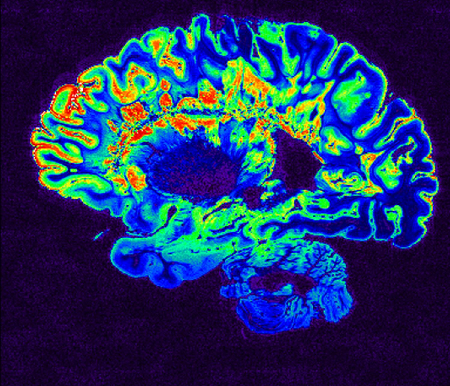 MRI_scan.jpg