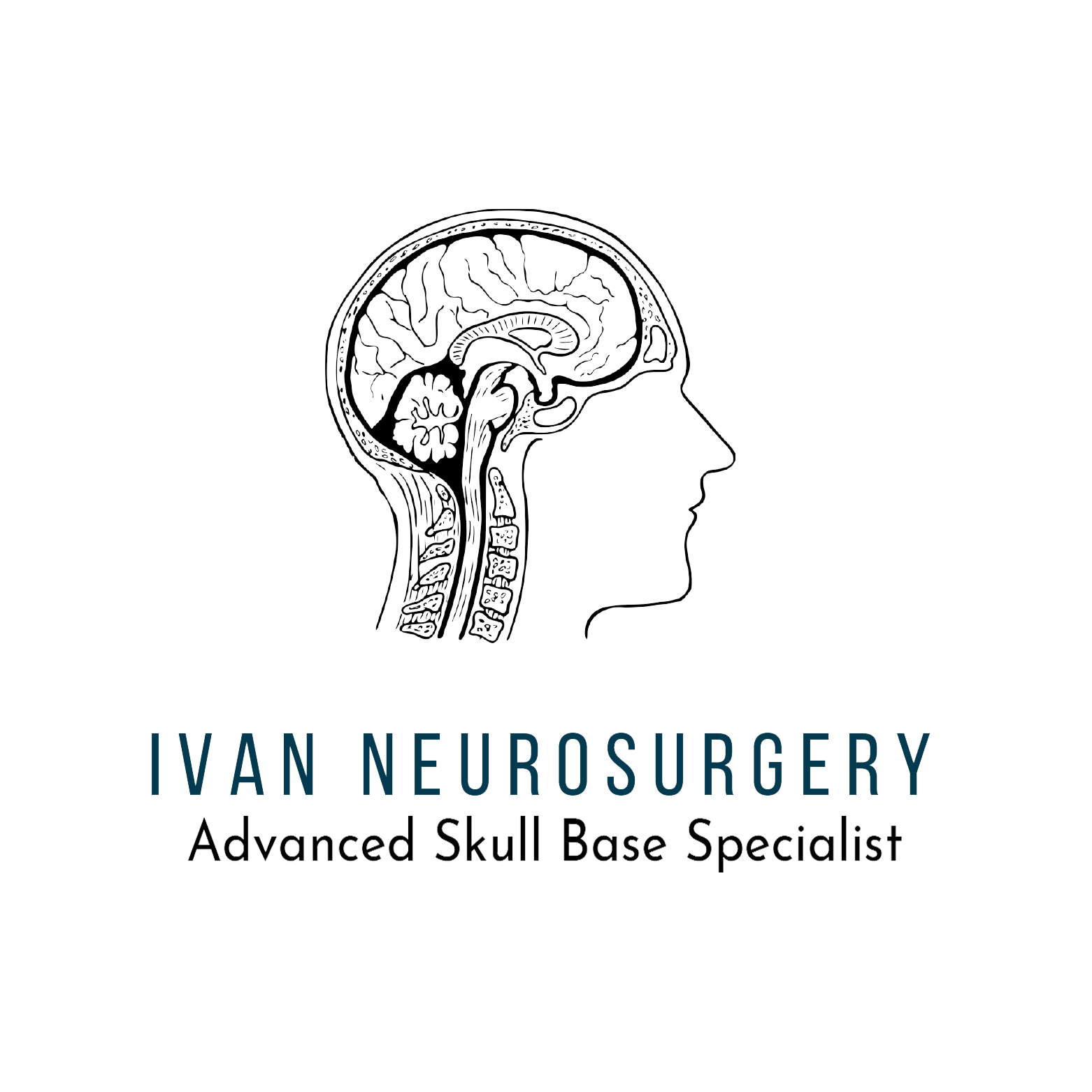 Ivan Neurosurgery
