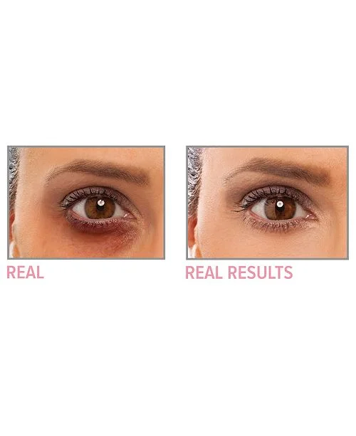 bye bye under eye