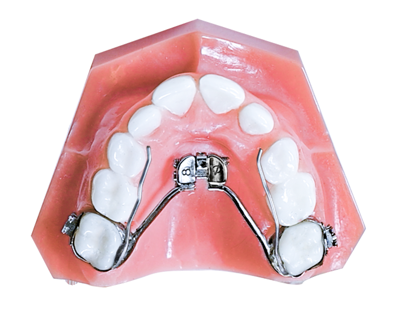 Anatomically Contoured Expander (ACE®) — Mixed Dentition Orthodontics
