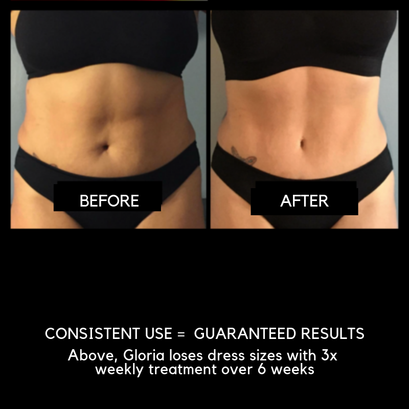 Nubody Laser Lipo Posts Facebook