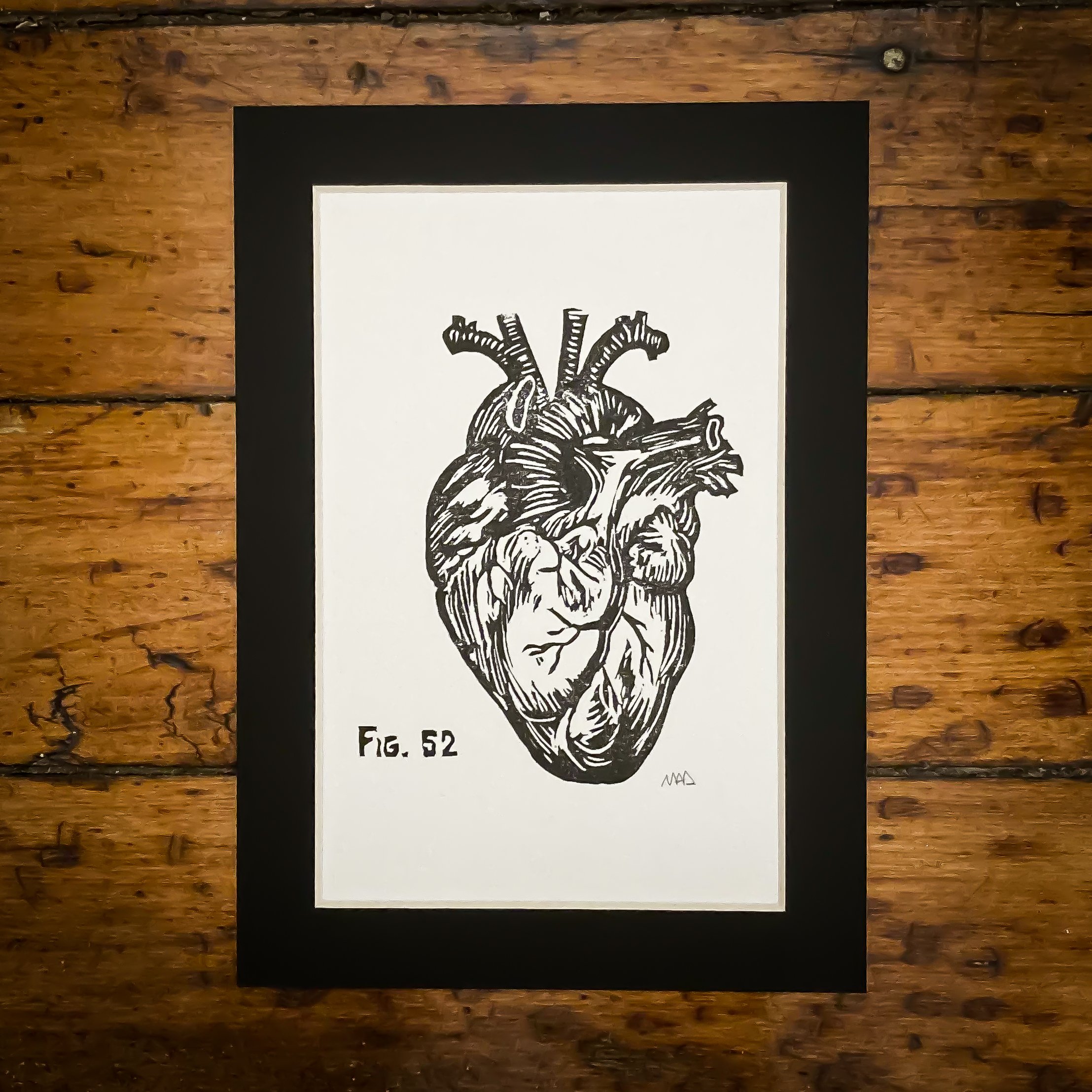 Anatomical Heart Collage Lino Block Print
