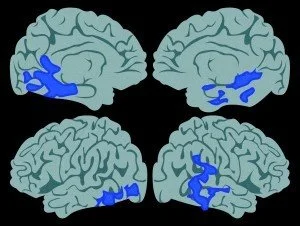 Brain Scan