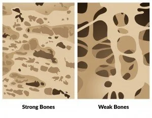Bones