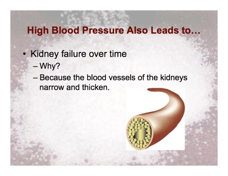 Kidneys