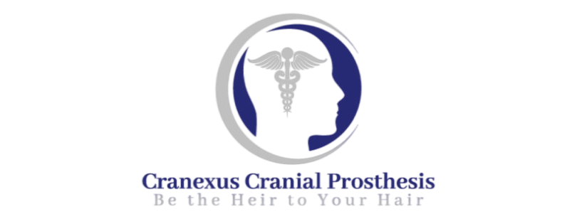 Cranexus Cranial Prosthesis