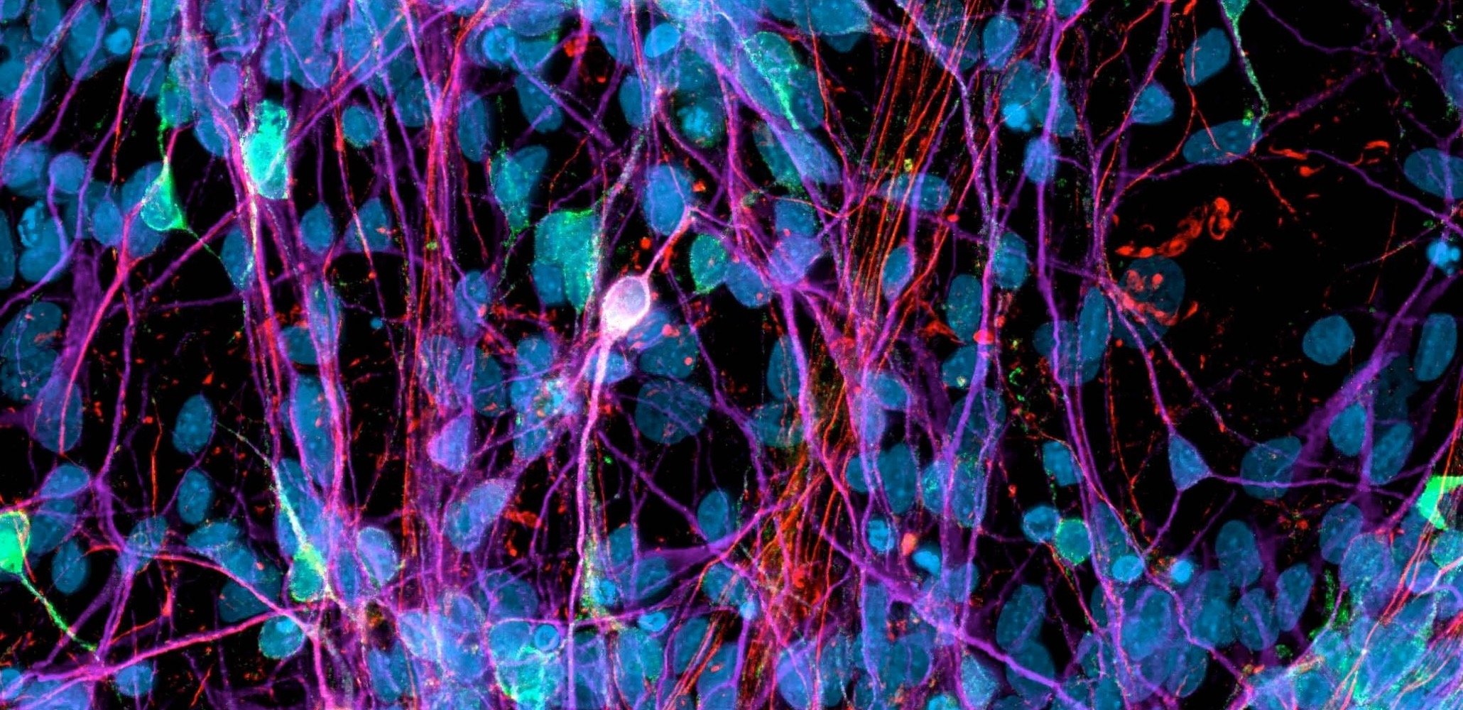 Fluorescence microscopy image of a network of hiPSC-derived neurons