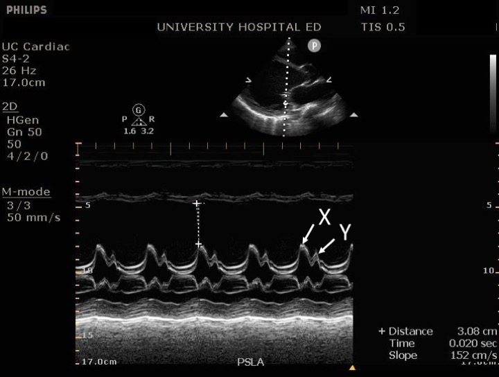 Cardiac Ultrasound Q&A — Taming the SRU.