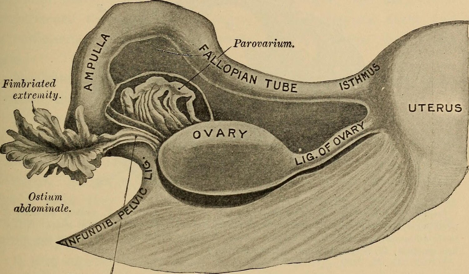 Annals of B Pod - Ovarian Torsion - Taming the SRU.