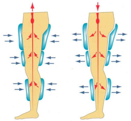 හෘද රෝගීන්ට ,ශල්‍යකර්ම වලින් බැහැර වූ නව්‍ය වෛද්‍ය චිකිත්සාවක්. - By ආචාර්‍ය ගාමිණී කාරියවසම්.