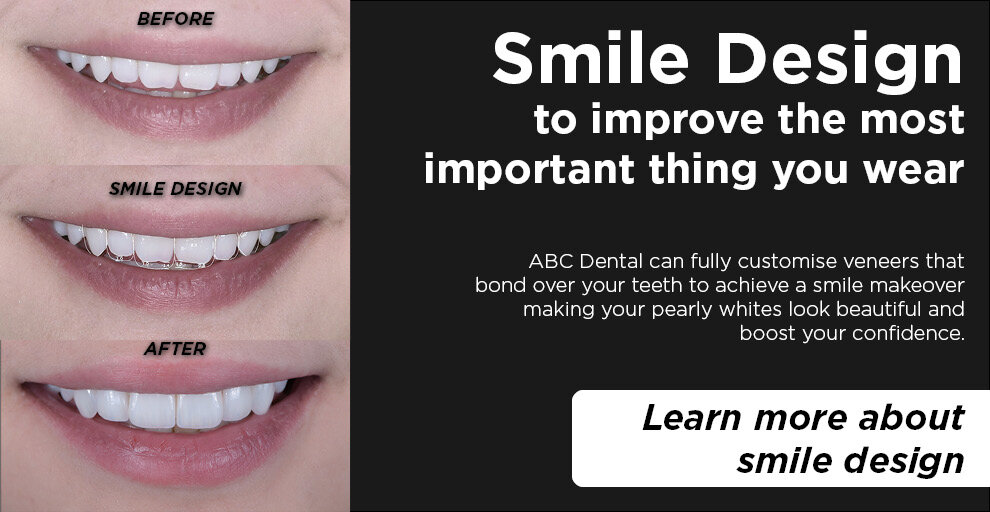 Improve your smile