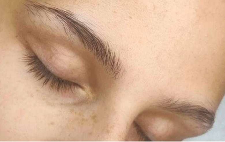 Brows before mapping and shaping.