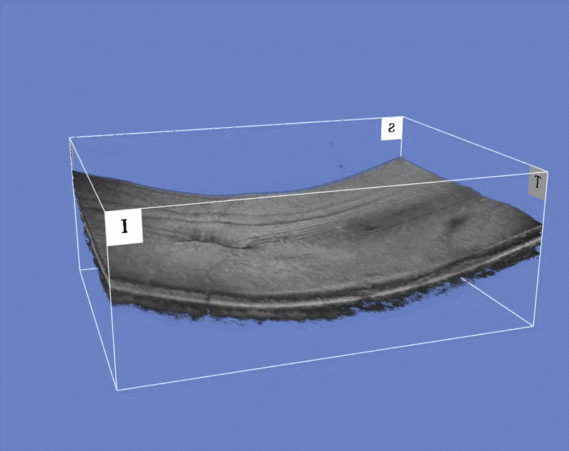 3D OCT scan