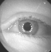 Eye movement imaging