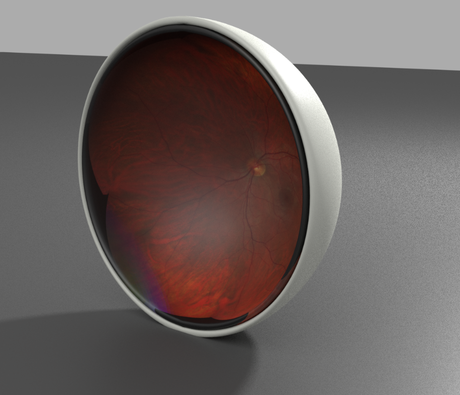 Ultra-wide retinal imaging