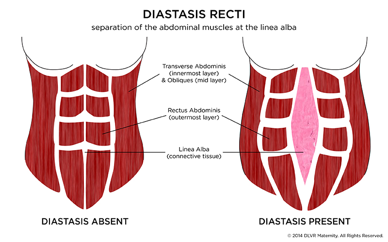 Linea Alba abdominis