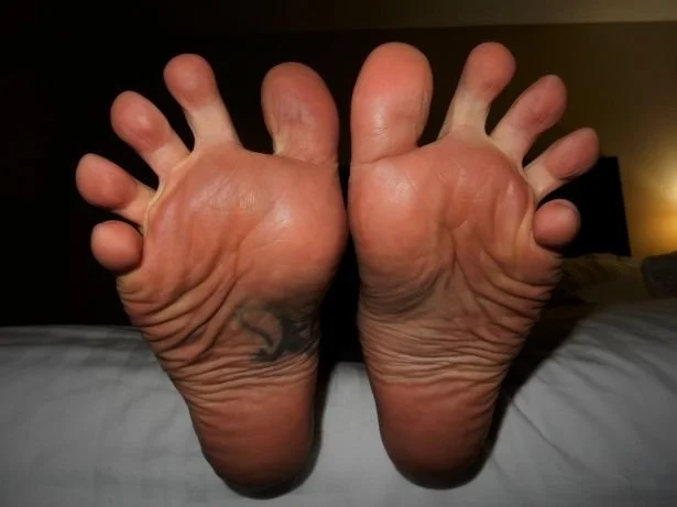 The soles of a man’s bare feet