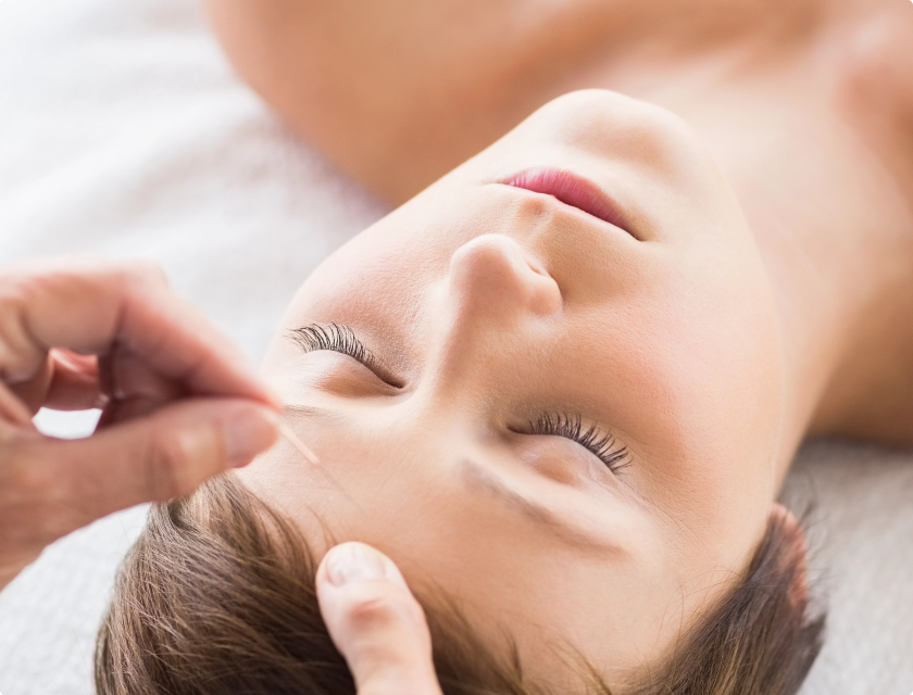 Acupuncture Image