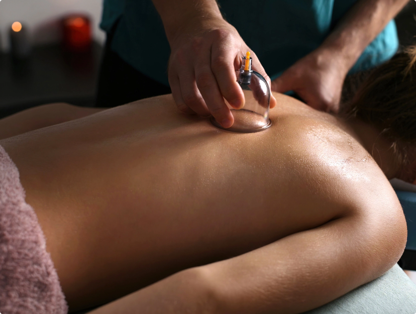 Cupping Therapy on Woman