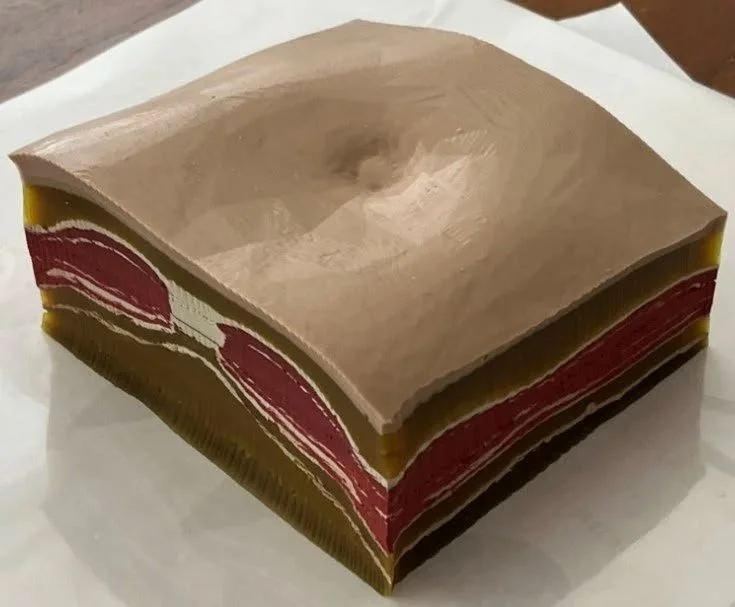 Heterogeneous abdominal wall tissue model