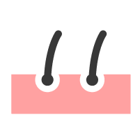 Melanoma
