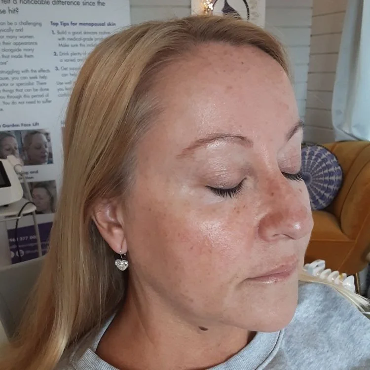 Pam before