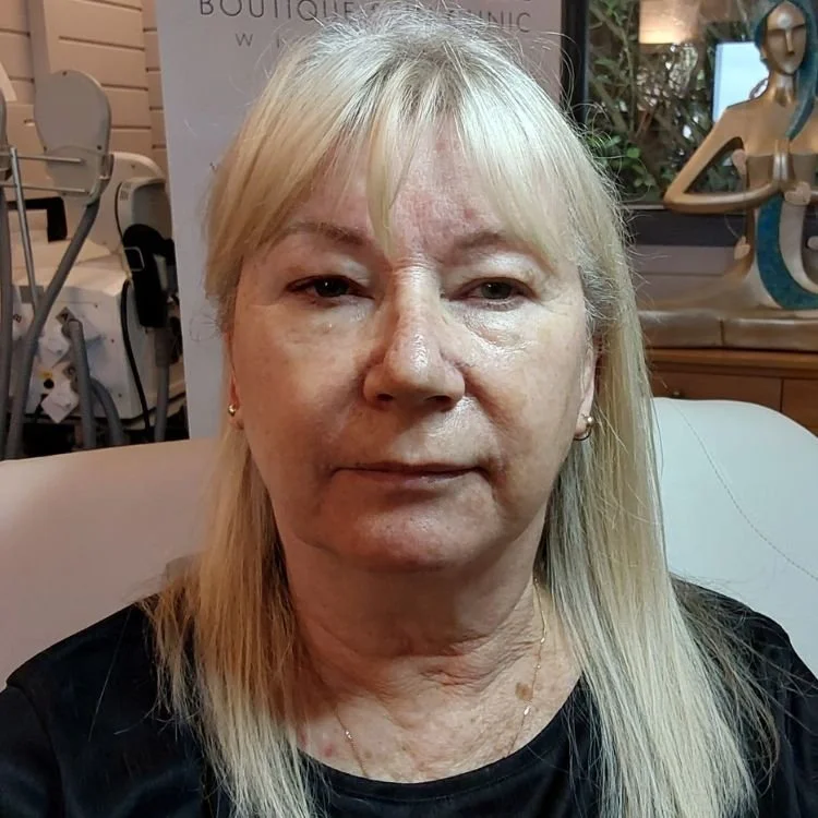 Sharron after The Ultimate Transformation