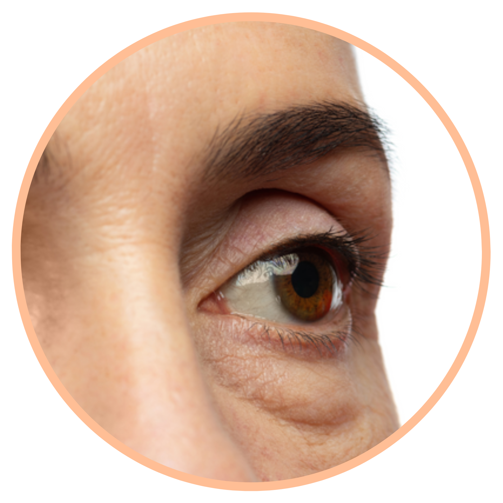 Under-Eye Rejuvenation