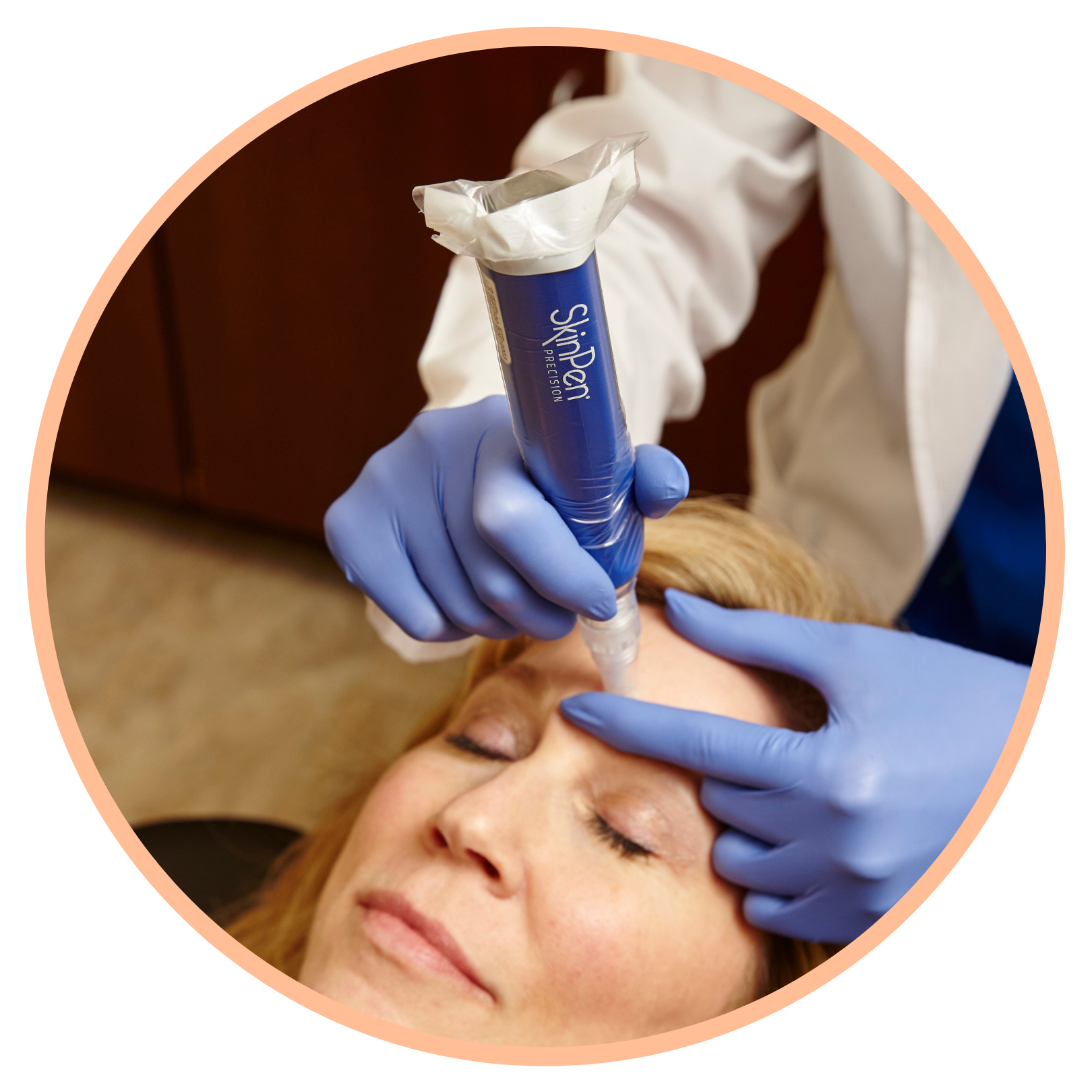 SkinPen Microneedling with PRP