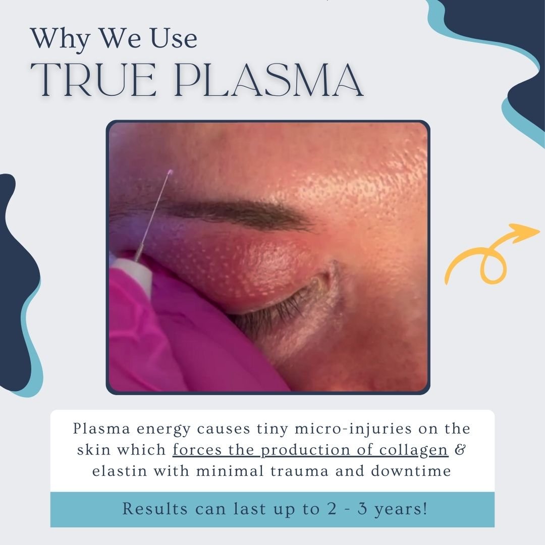 Jet, plasma, wrinkle reducing, eliminate wrinkles, fine lines, age spots