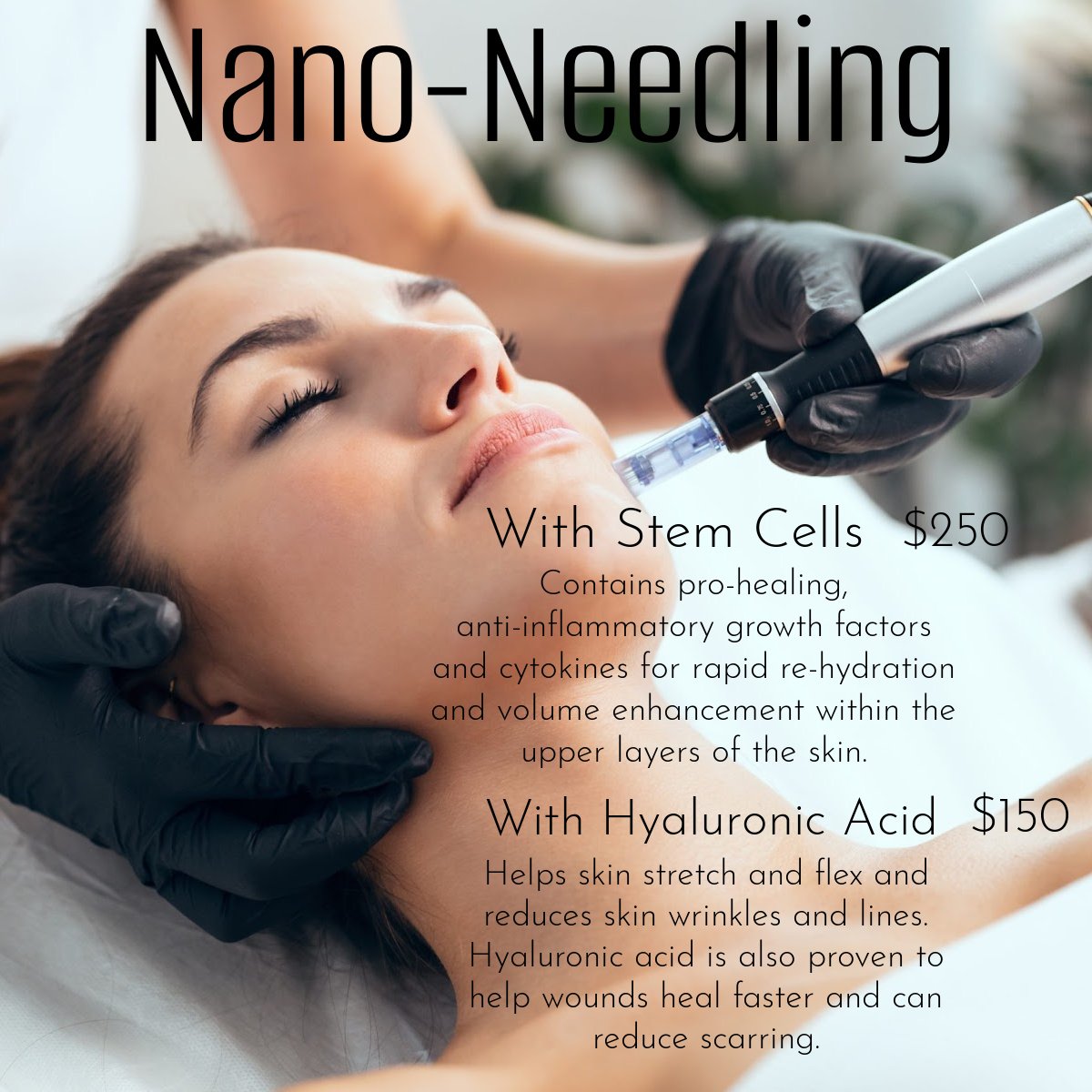 nano needling, nano-needling, nano-needle, Rezenerate NanoFacial, exfoliation, fine lines, blemishes, uneaven skin tone