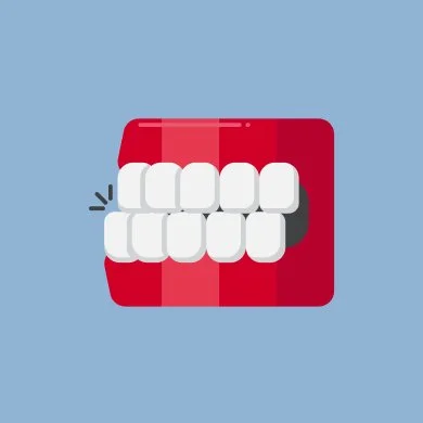 Underbite