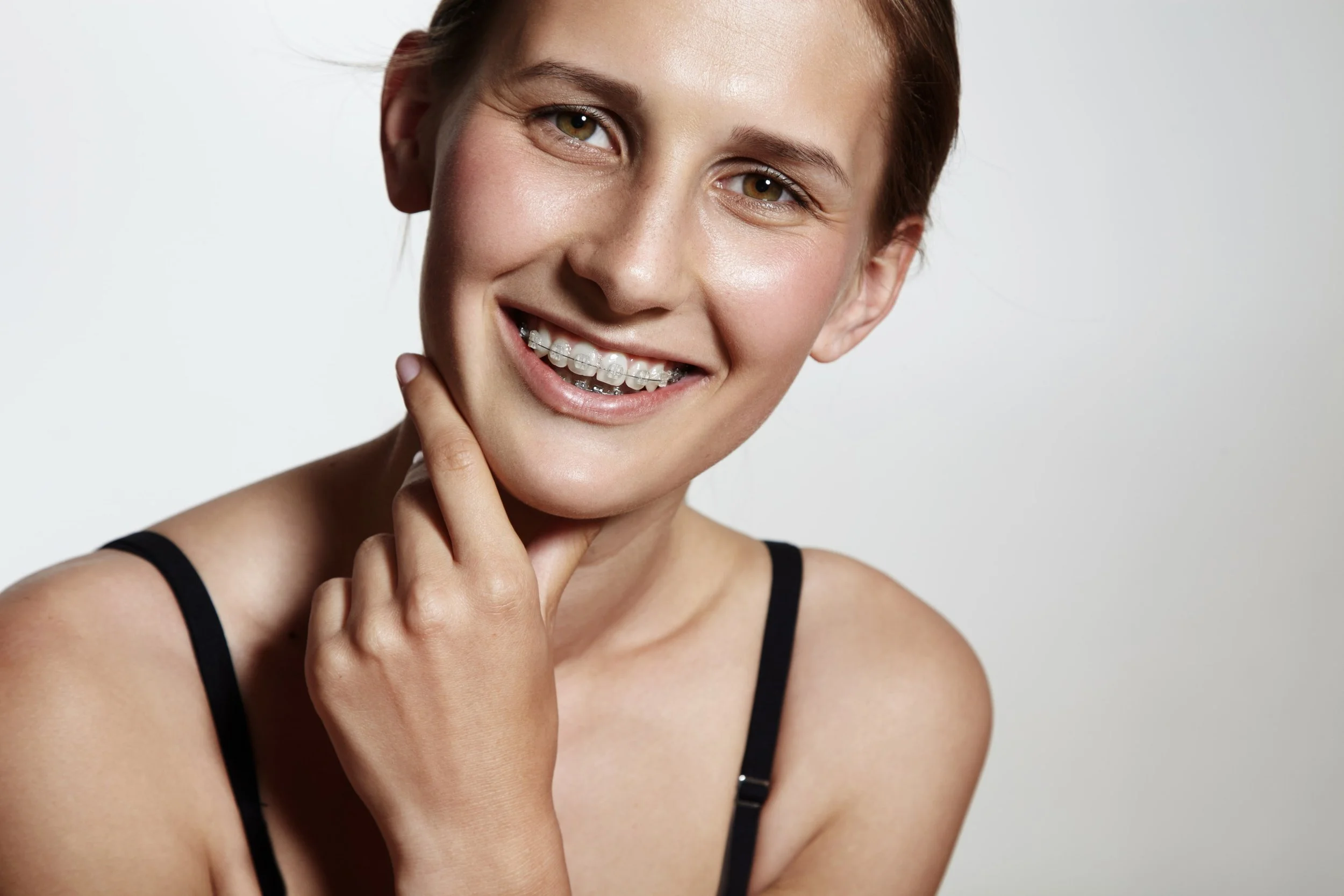 Traditional Metal Braces