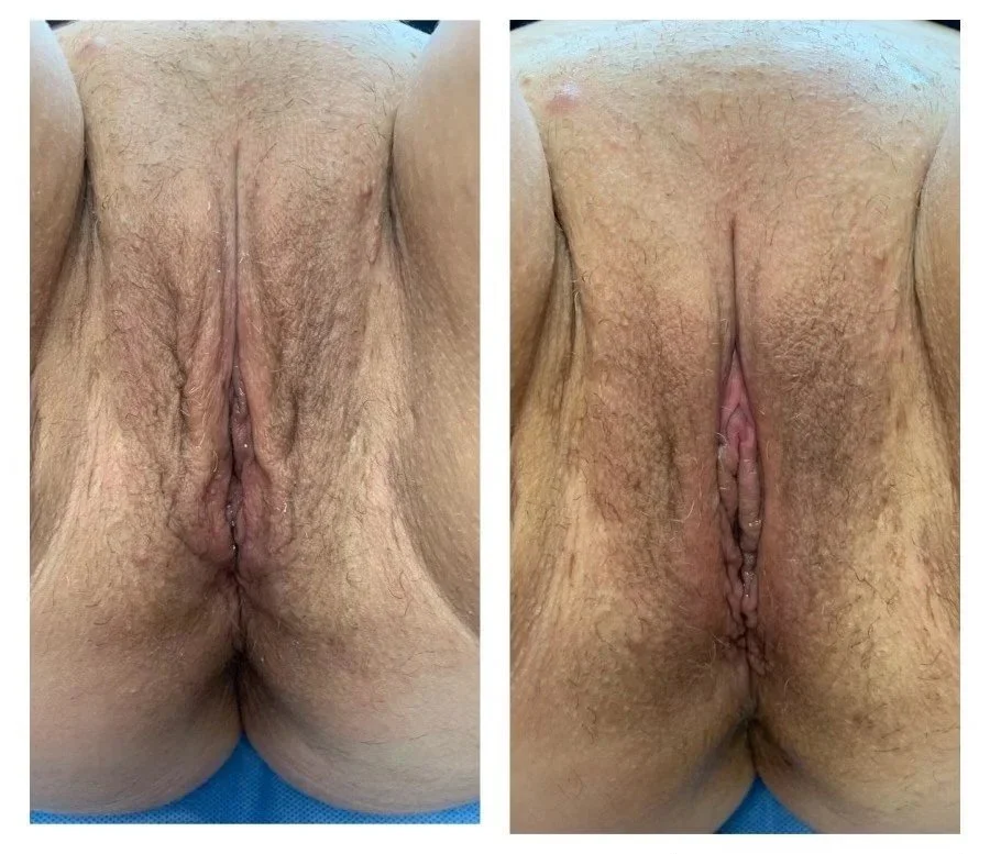 Medical content