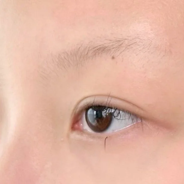 Very little brow hair