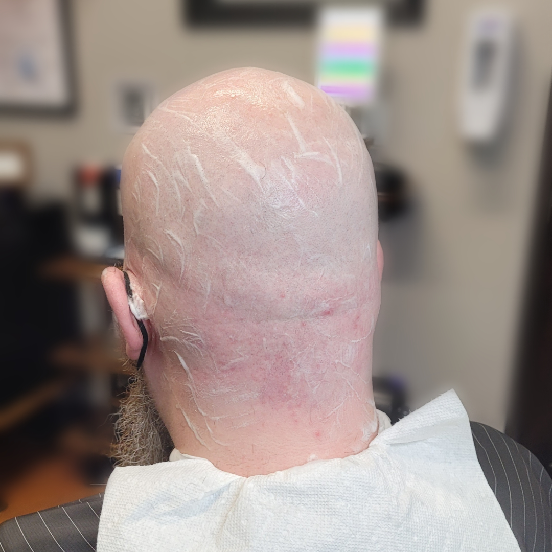 Head Shave