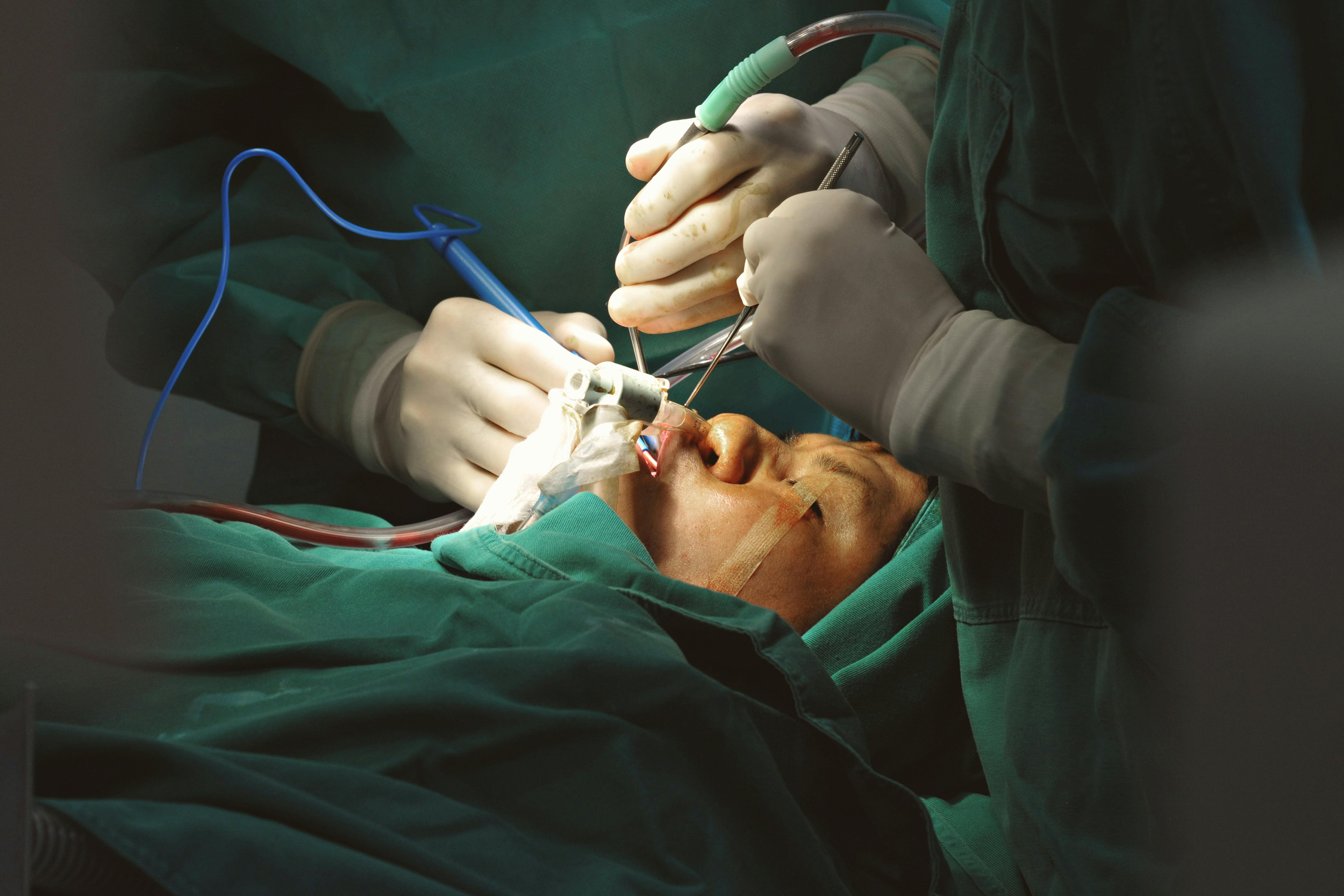 Facial reconstructive surgery