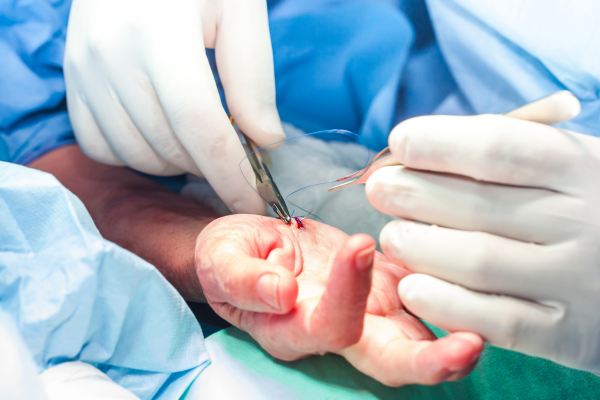 Hand and upper extremity reconstructive care